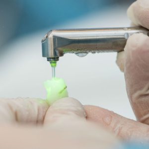 Le basi dell’odontoiatria Laser Assistita